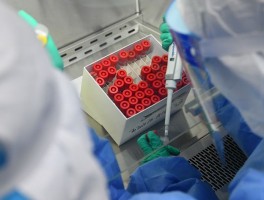 郫都区增1例确诊贴吧(郫都区新增一例)