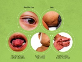 美国本土确诊首例病例是.美国发现首例确诊病例？