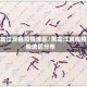 黑龙江炭疽疫情地区/黑龙江炭疽疫情地区分布