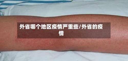 外省哪个地区疫情严重些/外省的疫情-第2张图片