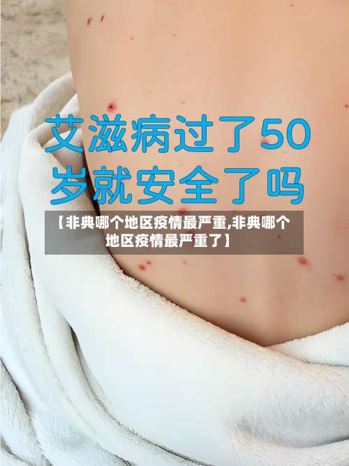 【非典哪个地区疫情最严重,非典哪个地区疫情最严重了】-第1张图片